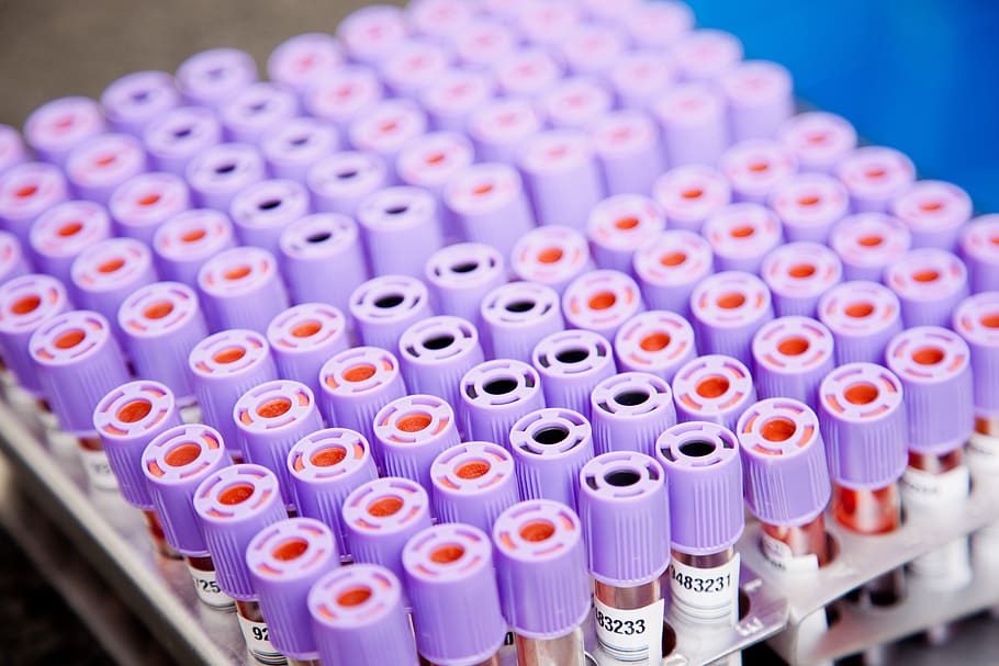 lab, paraugus, caurules, zinātniskais eksperiments, liela objektu grupa, veselības aprūpe un medicīna, asinis, asinsanalīze, laboratorijā, telpās, zinātne, mēģene, medicīniskā pārbaude, pētniecību, rindā, medicīniskā izpēte, izglītību, mēģenes plaukts, tuvplāns, tehnoloģijas, zils, nav cilvēku, bioloģija, kārtībā, violets, 5K